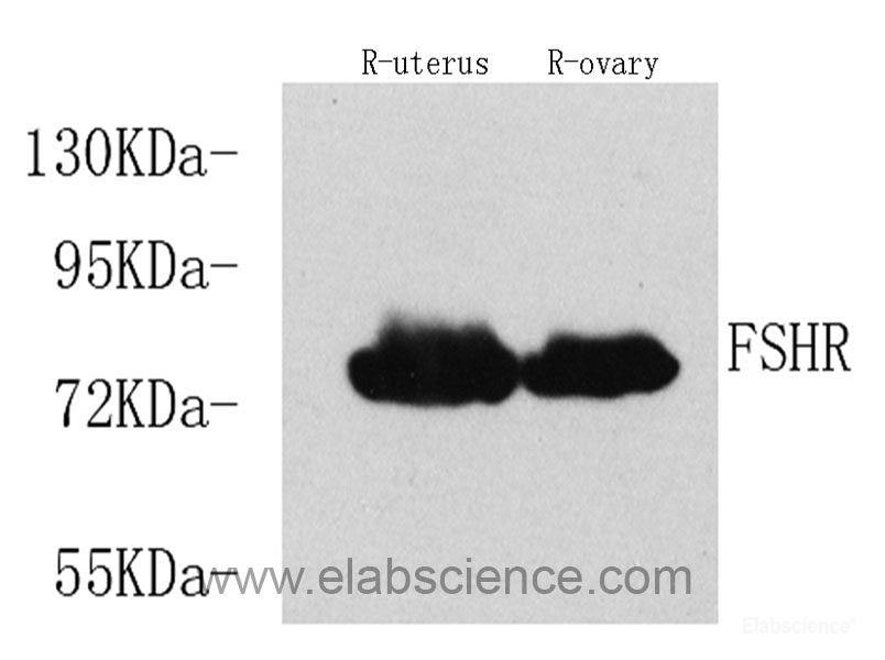 Immunohistochemistry analysis of paraffin-embedded rat bone  using BMP2 Monoclonal Antibody at dilution of 1:400.