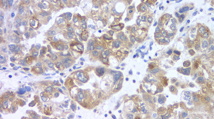 Immunohistochemistry analysis of paraffin-embedded mouse pneumonia  using COX2 Polyclonal Antibody at dilution of 1:500.
