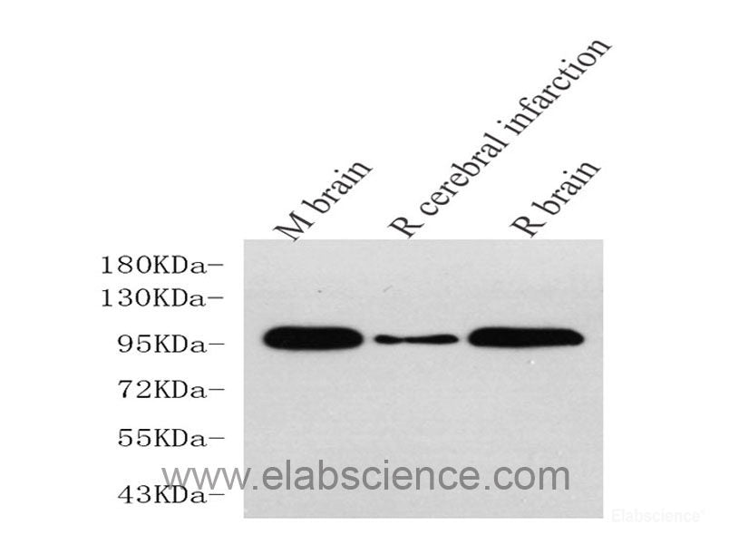 Immunohistochemistry analysis of paraffin-embedded human tonsil  using BECN1 Polyclonal Antibody at dilution of 1:500.
