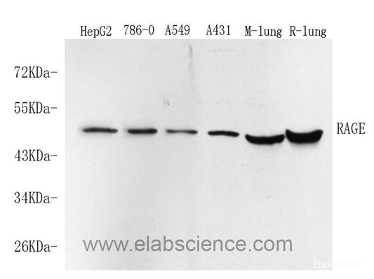 Immunohistochemistry analysis of paraffin-embedded mouse bone  using COL2A1 Monoclonal Antibody at dilution of 1:400.