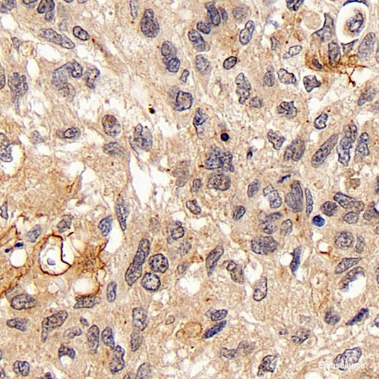 Immunohistochemistry analysis of paraffin-embedded human tonsil tissue  using Galectin 3 Monoclonal Antibody at dilution of 1:400.