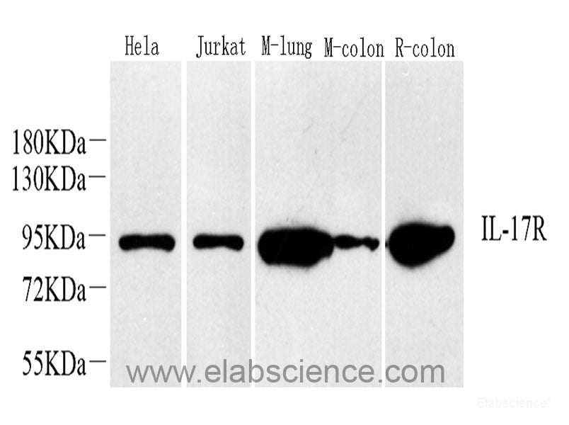 Immunohistochemistry analysis of paraffin-embedded human tonsil  using SIRT7 Polyclonal Antibody at dilution of 1:200.