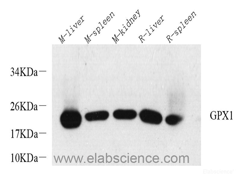 Immunohistochemistry analysis of paraffin-embedded mouse brain  using GRIN2B Polyclonal Antibody at dilution of 1:200.