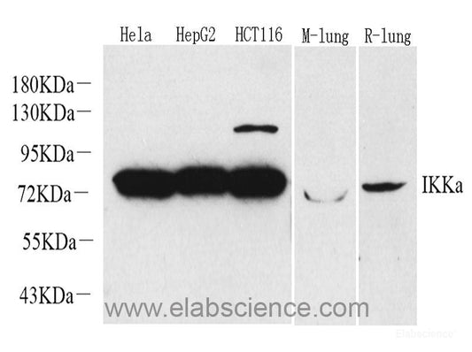 Western Blot analysis of various samples using COL3A1 Polyclonal Antibody at dilution of 1:750.