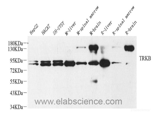 Immunohistochemistry analysis of paraffin-embedded human lung  using CXCR7 Polyclonal Antibody at dilution of 1:100.