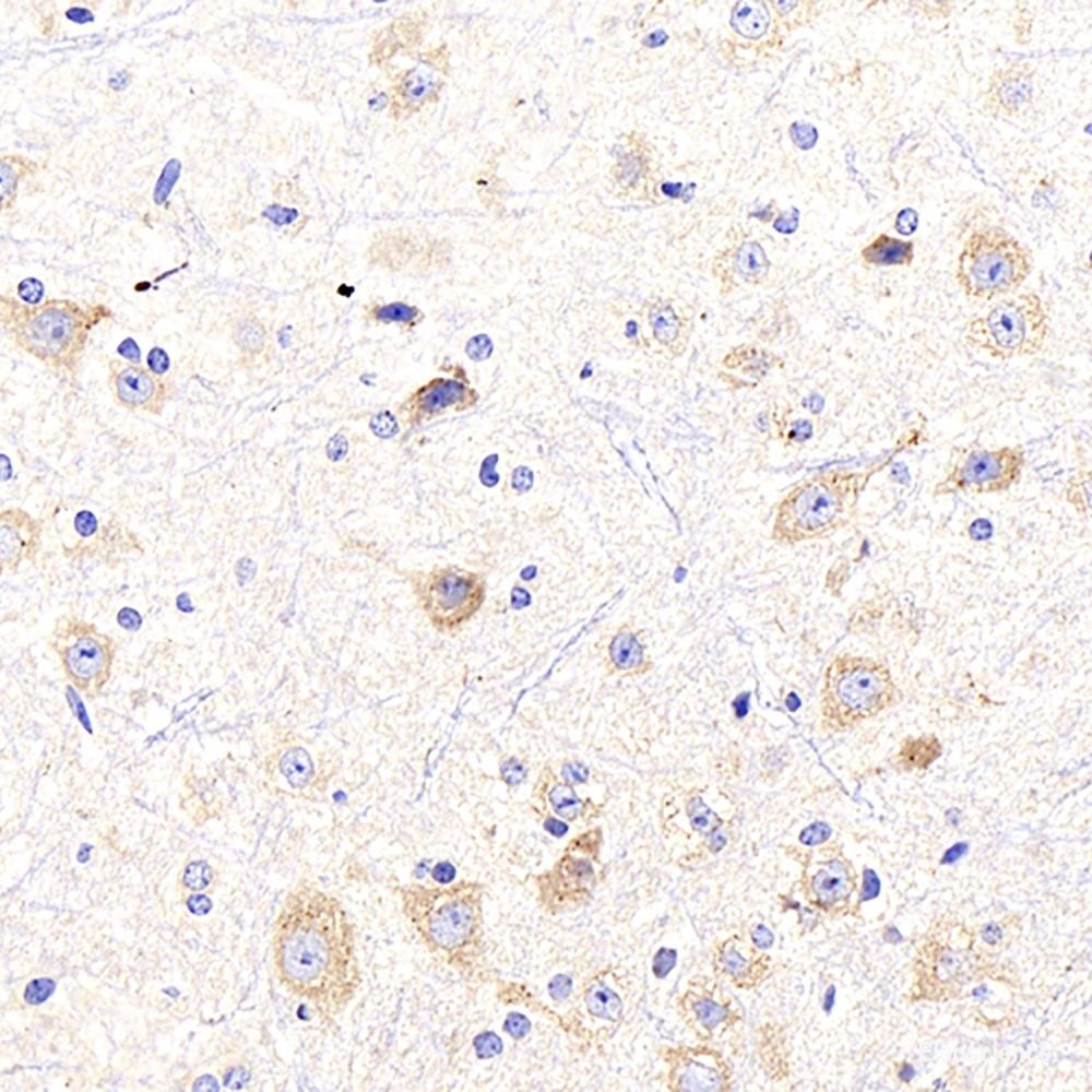 Immunohistochemistry analysis of paraffin-embedded mouse brain  using beta Amyloid Polyclonal Antibody at dilution of 1:300.
