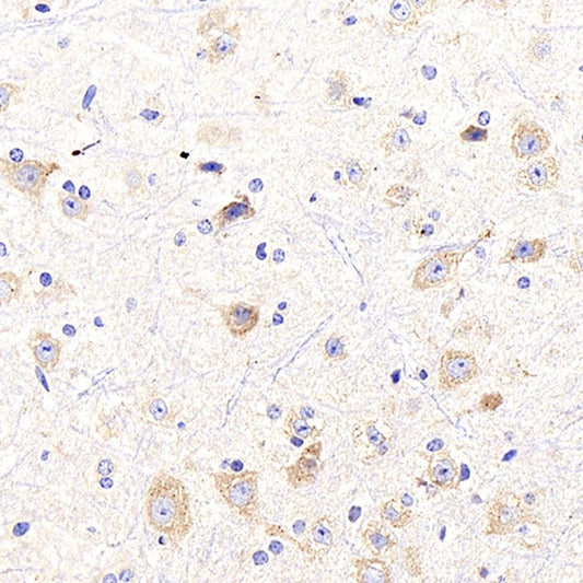 Immunohistochemistry analysis of paraffin-embedded mouse brain  using beta Amyloid Polyclonal Antibody at dilution of 1:300.