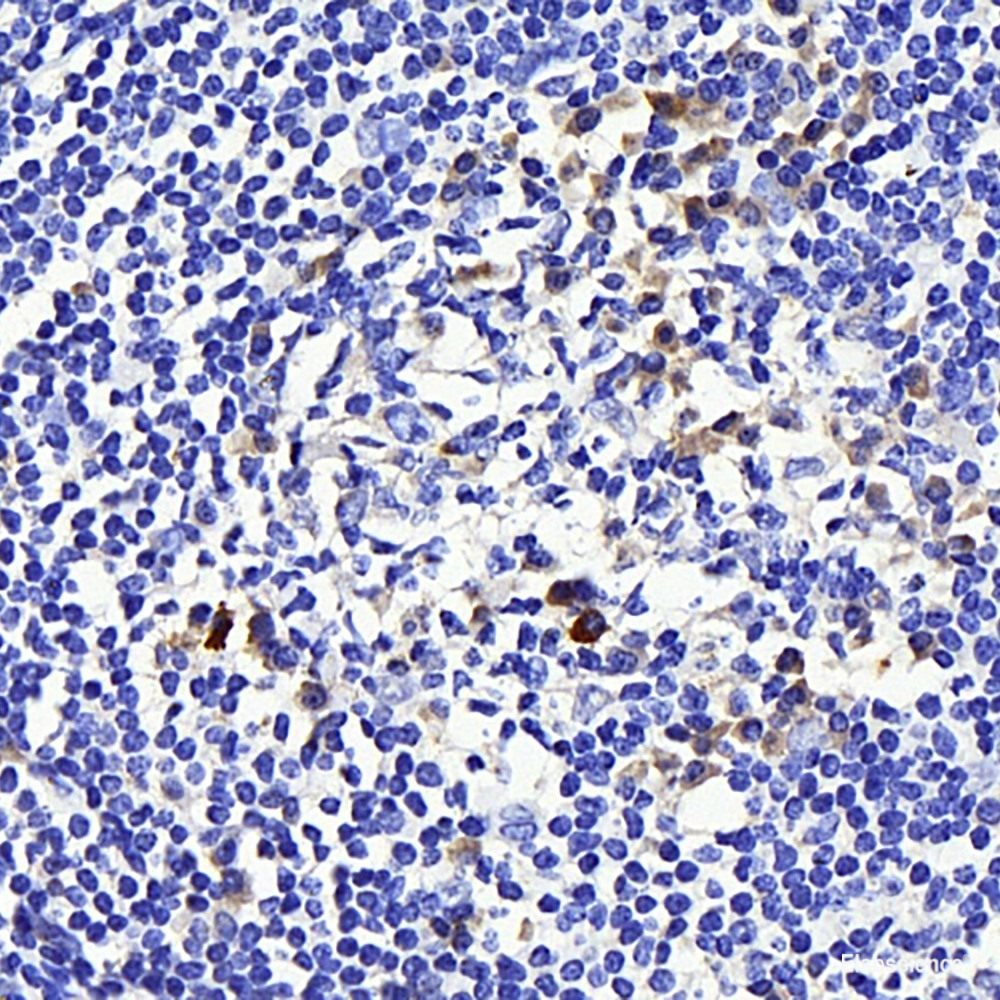 Immunohistochemistry analysis of paraffin-embedded mouse lung  using MYD88 Polyclonal Antibody at dilution of 1:200.