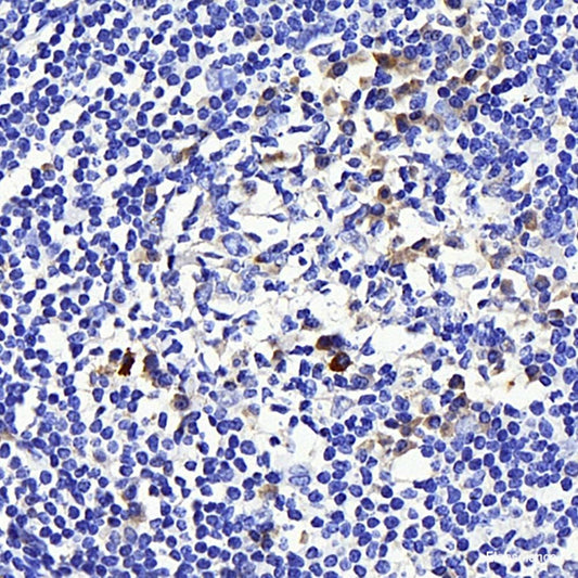 Immunohistochemistry analysis of paraffin-embedded mouse lung  using MYD88 Polyclonal Antibody at dilution of 1:200.