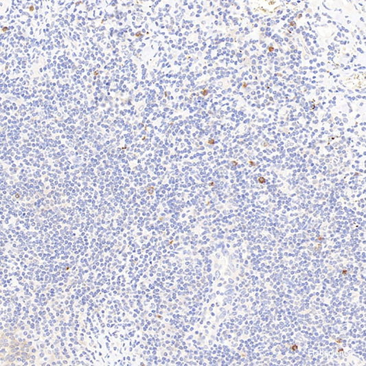 Western Blot analysis of various samples using ERK 2 Polyclonal Antibody at dilution of 1:800.