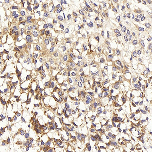 Immunohistochemistry analysis of paraffin-embedded mouse brain  using MBP Polyclonal Antibody at dilution of 1:600.