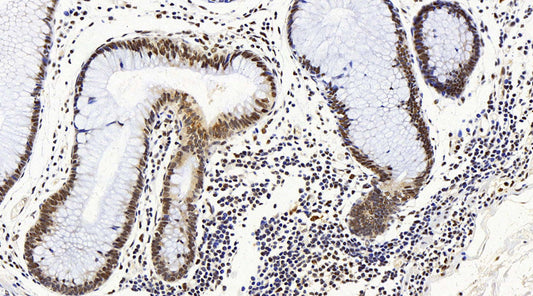 Immunohistochemistry analysis of paraffin-embedded mouse spleen  using CD284 Monoclonal Antibody at dilution of 1:400.