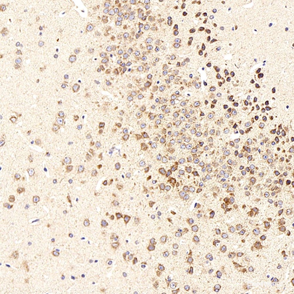 Immunohistochemistry analysis of paraffin-embedded human tonsil  using Histone H4 Polyclonal Antibody at dilution of 1:400.
