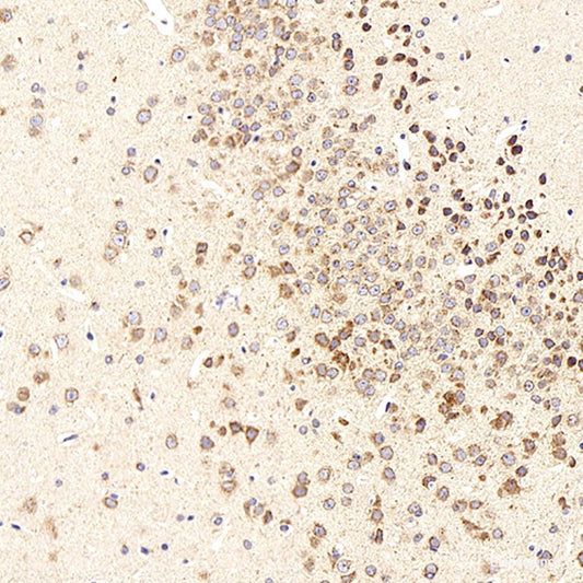Immunohistochemistry analysis of paraffin-embedded human tonsil  using Histone H4 Polyclonal Antibody at dilution of 1:400.