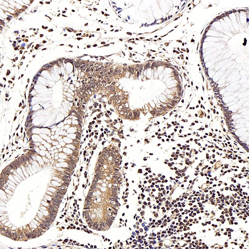 Immunohistochemistry analysis of paraffin-embedded mouse colon  using RELB Polyclonal Antibody at dilution of 1:400.