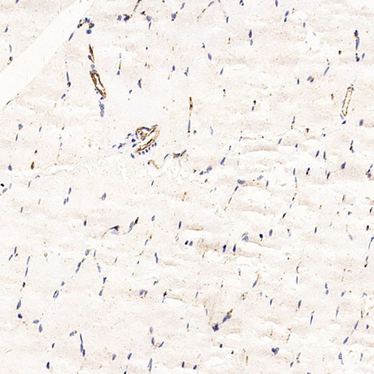 Western Blot analysis of various samples using AGT Polyclonal Antibody at dilution of 1:600.