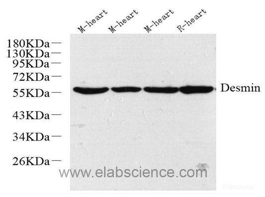 Immunohistochemistry analysis of paraffin-embedded mouse liver  using E-Cadherin Monoclonal Antibody at dilution of 1:300.