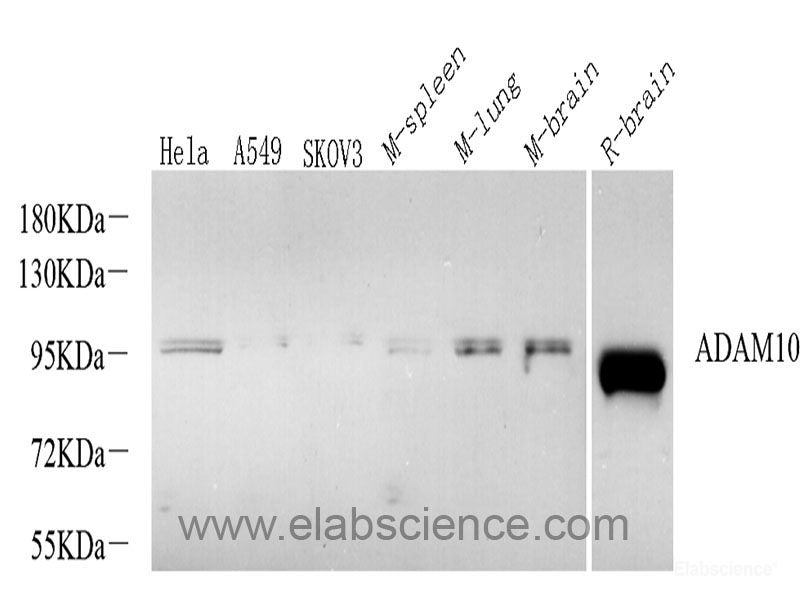 Immunohistochemistry analysis of paraffin-embedded mouse brain  using AIF1 Polyclonal Antibody at dilution of 1:300.
