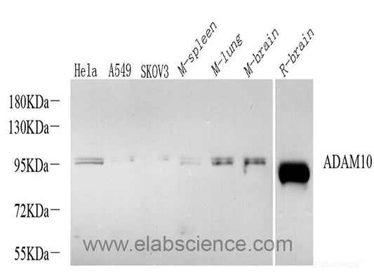 Immunohistochemistry analysis of paraffin-embedded mouse brain  using AIF1 Polyclonal Antibody at dilution of 1:300.