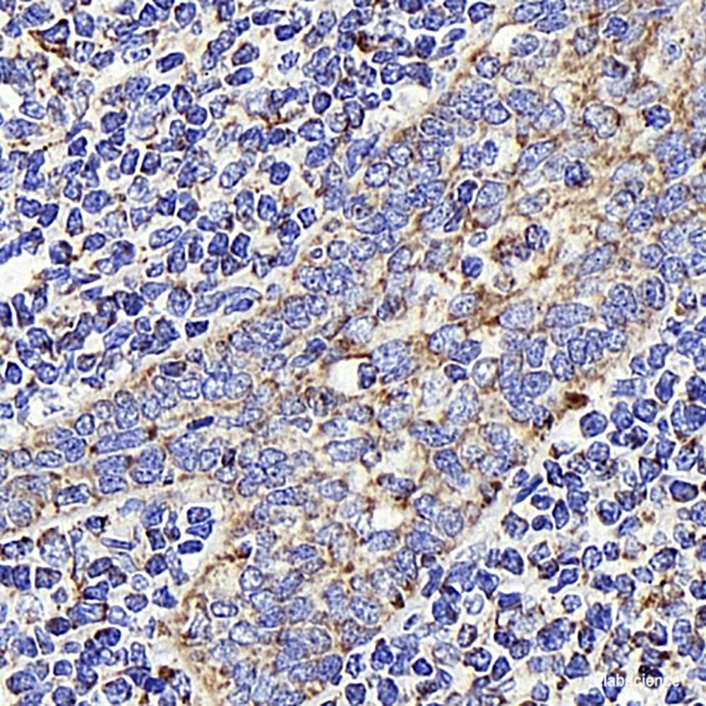 Immunohistochemistry analysis of paraffin-embedded human liver  using Connexin-40 Polyclonal Antibody at dilution of 1:400.