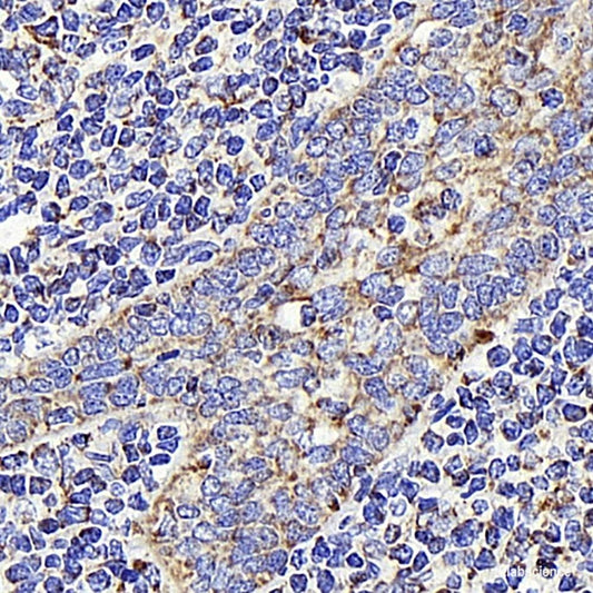 Immunohistochemistry analysis of paraffin-embedded human liver  using Connexin-40 Polyclonal Antibody at dilution of 1:400.