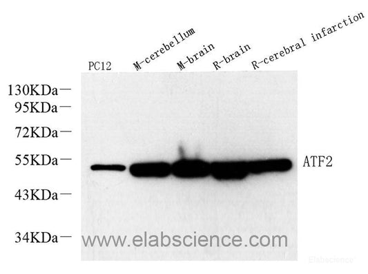 Western Blot analysis of various samples using CYCS Polyclonal Antibody at dilution of 1:1000.