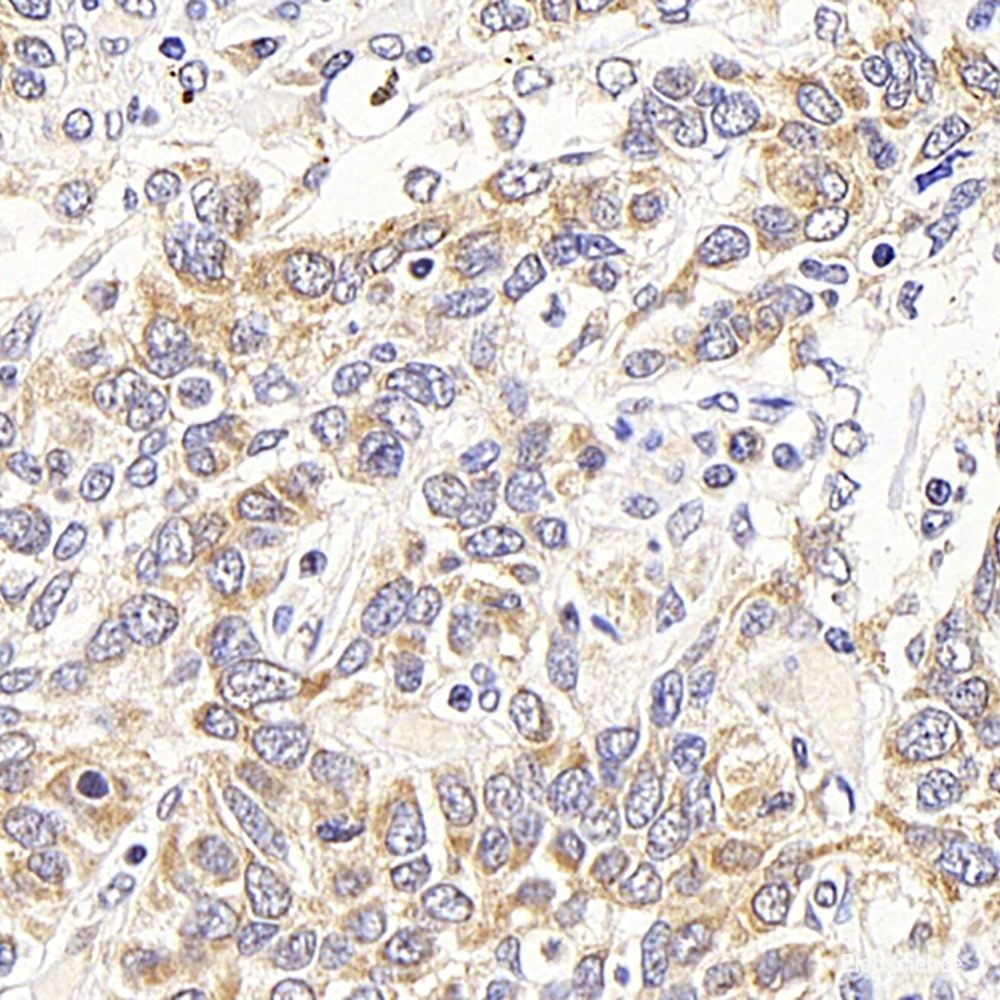Immunohistochemistry analysis of paraffin-embedded human tonsil  using TLR9 Polyclonal Antibody at dilution of 1:200.