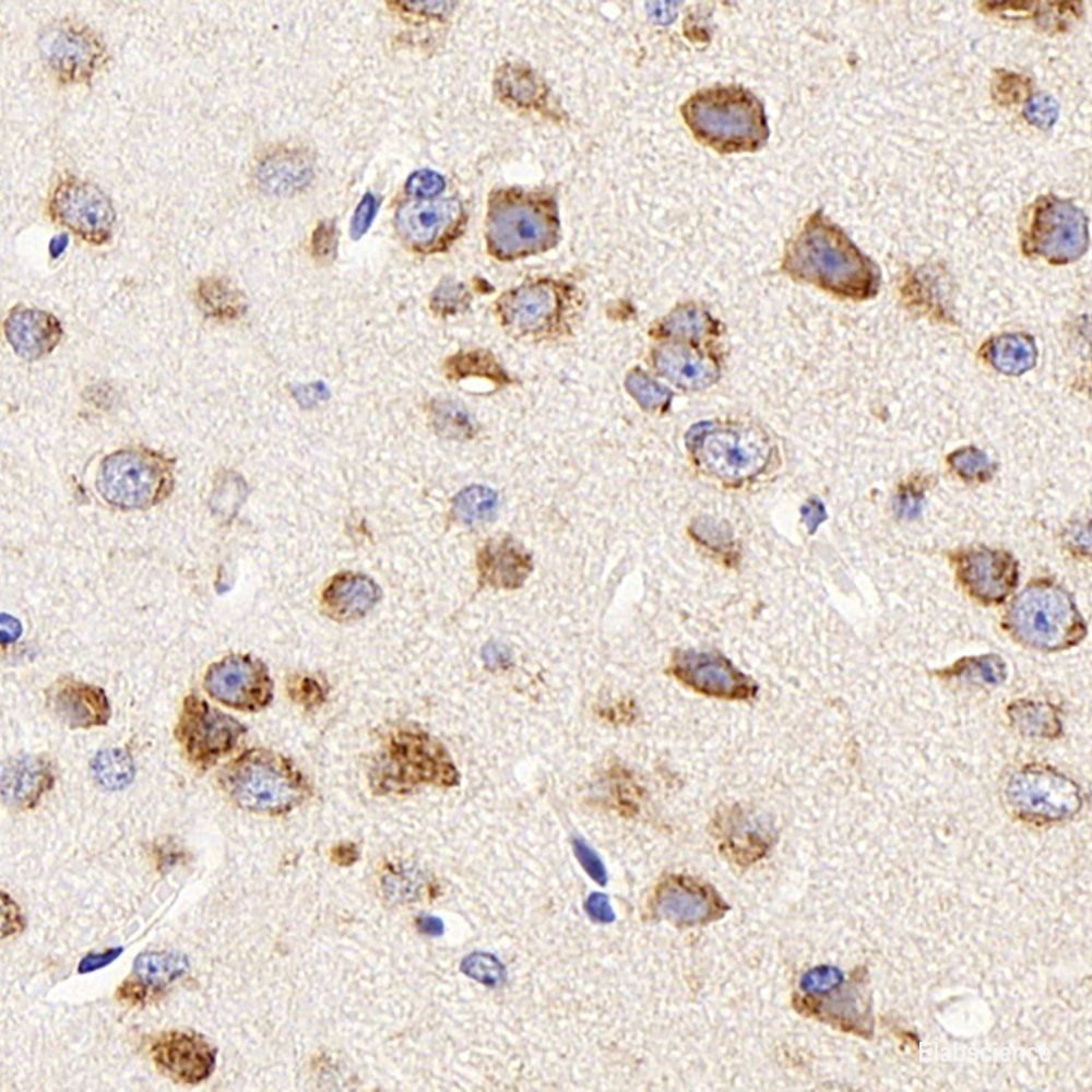 Immunohistochemistry analysis of paraffin-embedded rat brain  using AQP4 Polyclonal Antibody at dilution of 1:400.
