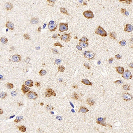 Immunohistochemistry analysis of paraffin-embedded rat brain  using AQP4 Polyclonal Antibody at dilution of 1:400.