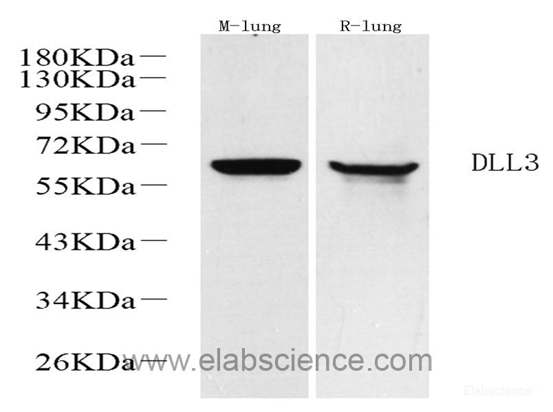 Immunohistochemistry analysis of paraffin-embedded human kidney  using NES Monoclonal Antibody at dilution of 1:400.