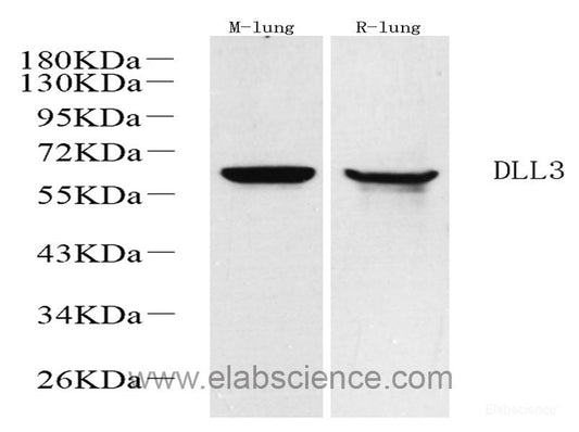 Immunohistochemistry analysis of paraffin-embedded human kidney  using NES Monoclonal Antibody at dilution of 1:400.