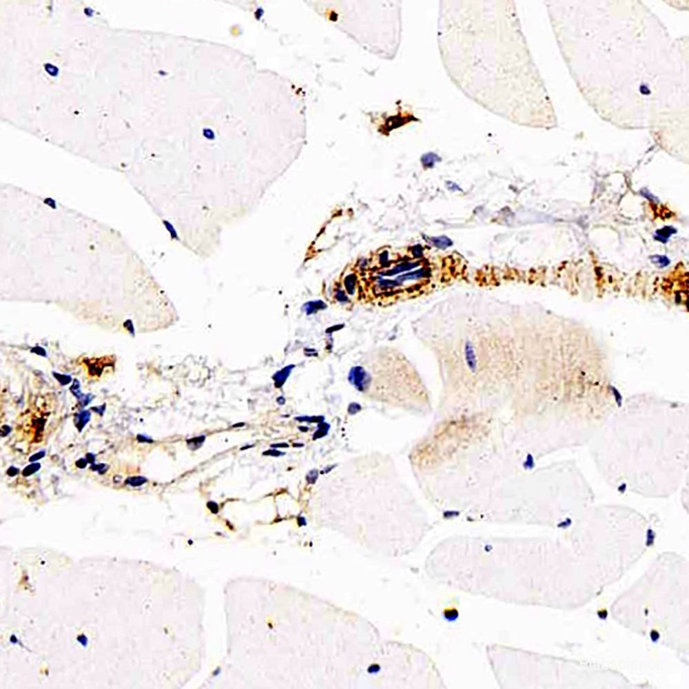 Immunohistochemistry analysis of paraffin-embedded mouse liver  using CD45 Polyclonal Antibody at dilution of 1:500.