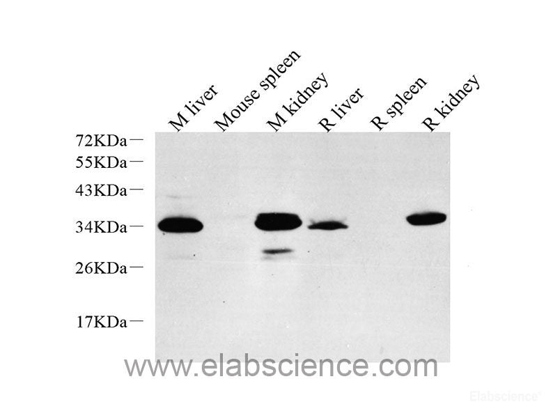 Immunohistochemistry analysis of paraffin-embedded mouse skeletal muscle  using GLUT-4 Polyclonal Antibody at dilution of 1:500.