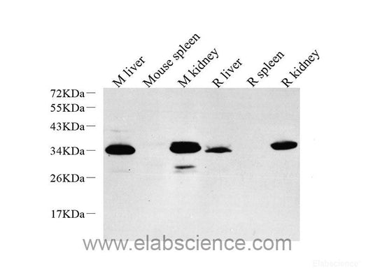 Immunohistochemistry analysis of paraffin-embedded mouse skeletal muscle  using GLUT-4 Polyclonal Antibody at dilution of 1:500.