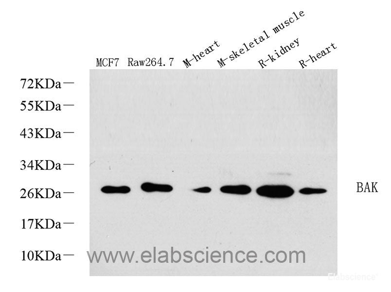 Immunohistochemistry analysis of paraffin-embedded human tonsil  using CD169 Polyclonal Antibody at dilution of 1:300.