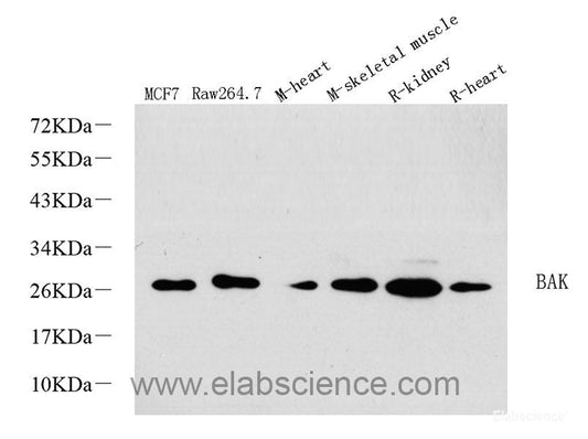 Immunohistochemistry analysis of paraffin-embedded human tonsil  using CD169 Polyclonal Antibody at dilution of 1:300.