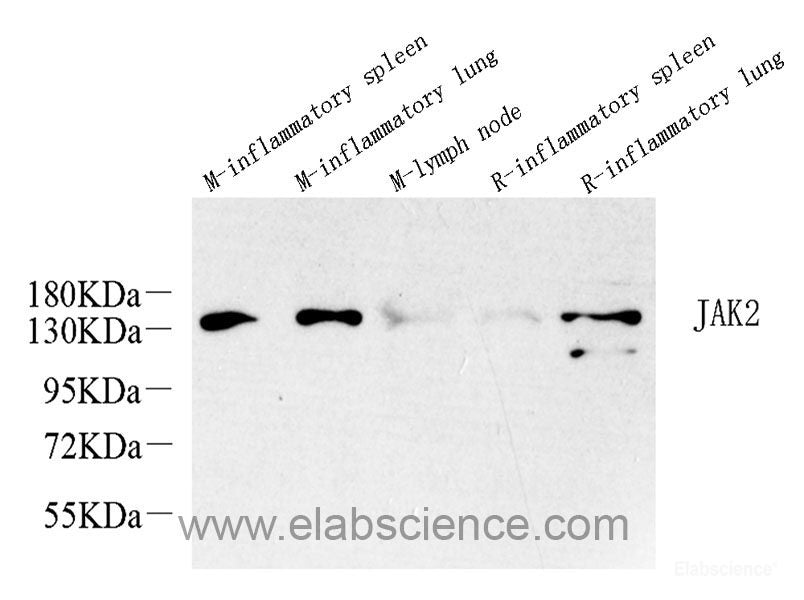 Immunohistochemistry analysis of paraffin-embedded mouse striatum  using TH Monoclonal Antibody at dilution of 1:1000.