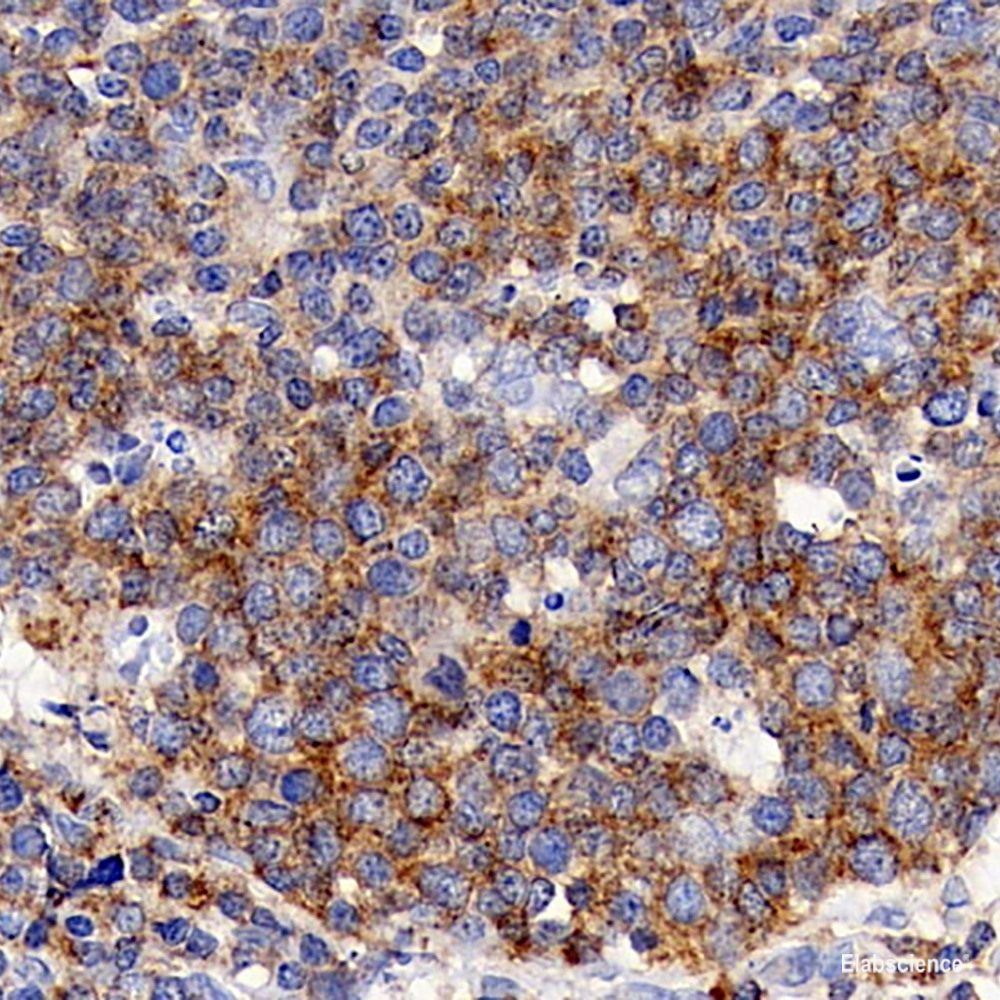 Immunohistochemistry analysis of paraffin-embedded mouse brain  using AIF1 Monoclonal Antibody at dilution of 1:400.