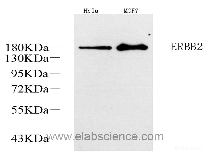 Immunohistochemistry analysis of paraffin-embedded human tonsil  using PERK Polyclonal Antibody at dilution of 1:400.