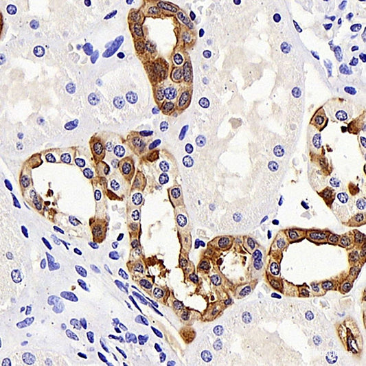 Immunohistochemistry analysis of paraffin-embedded human tonsil  using CD192 Polyclonal Antibody at dilution of 1:300.