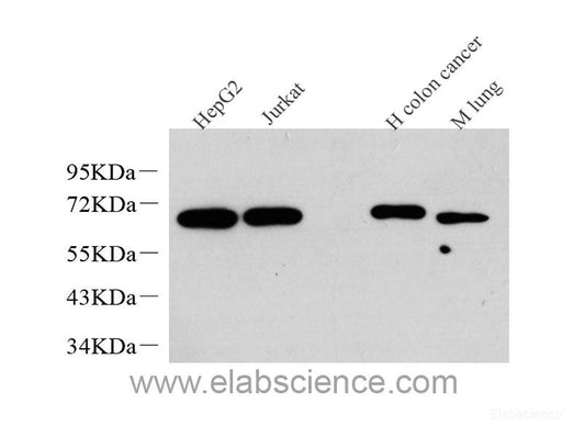Immunohistochemistry analysis of paraffin-embedded mouse kidney  using NPHS1 Polyclonal Antibody at dilution of 1:1000.