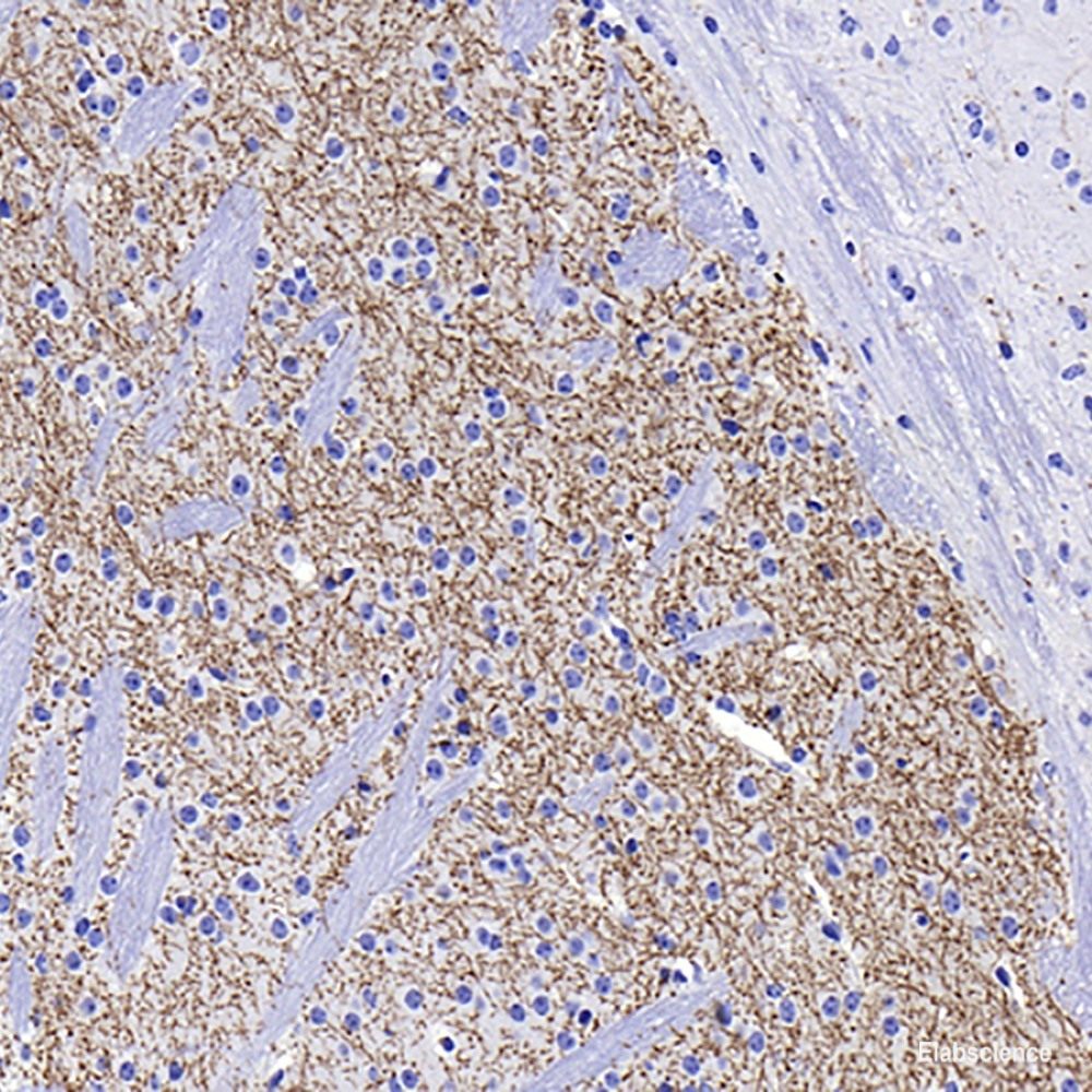 Immunohistochemistry analysis of paraffin-embedded human stomach  using Mineralocorticoid receptor Polyclonal Antibody at dilution of 1:300.