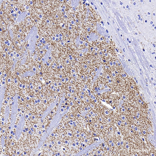 Immunohistochemistry analysis of paraffin-embedded human stomach  using Mineralocorticoid receptor Polyclonal Antibody at dilution of 1:300.