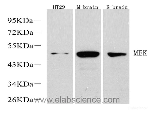 Western Blot analysis of various samples using EGFR Polyclonal Antibody at dilution of 1:1000.