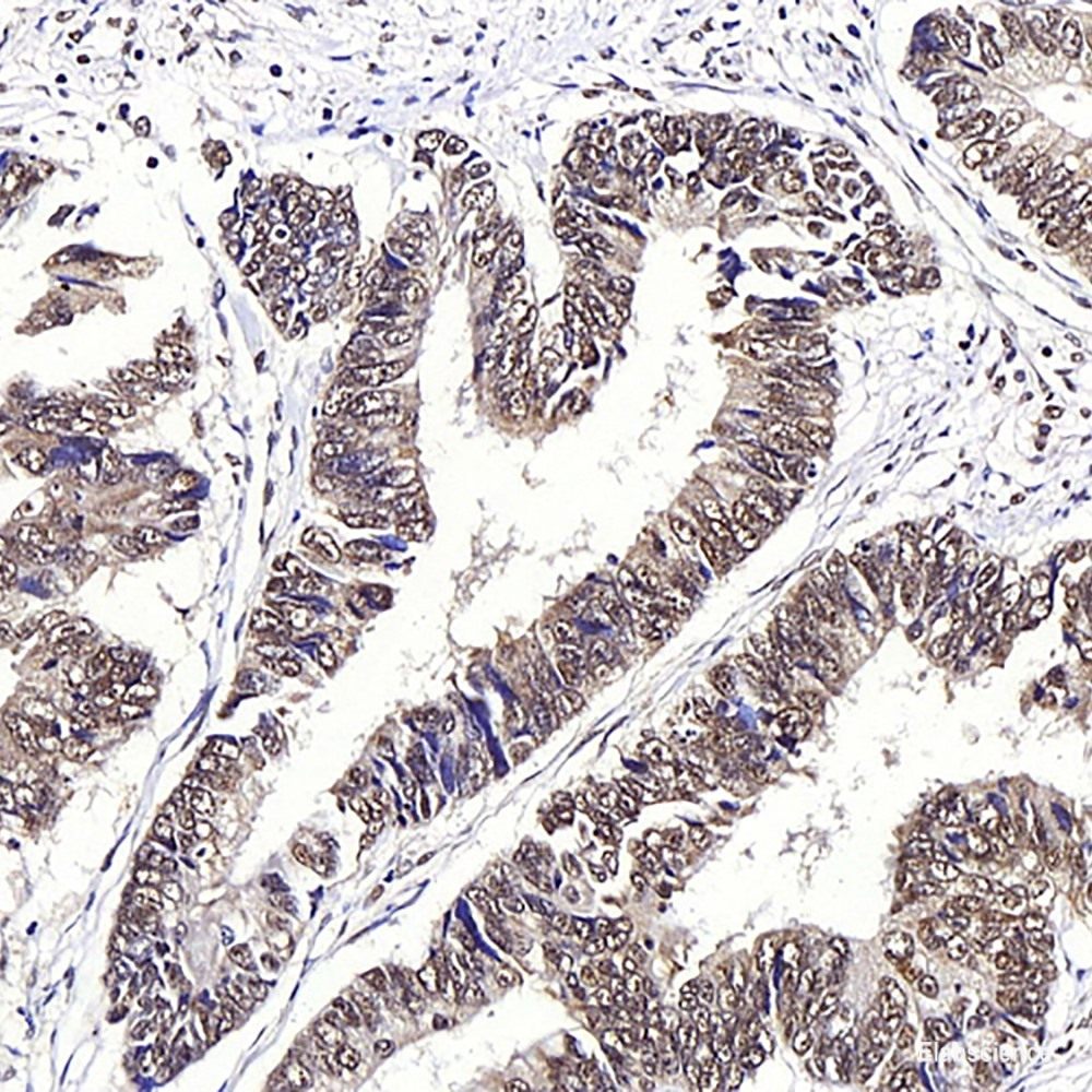 Immunohistochemistry analysis of paraffin-embedded Mouse muscle  using MYL2 Polyclonal Antibody at dilution of 1:300.