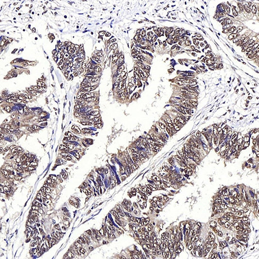 Immunohistochemistry analysis of paraffin-embedded Mouse muscle  using MYL2 Polyclonal Antibody at dilution of 1:300.