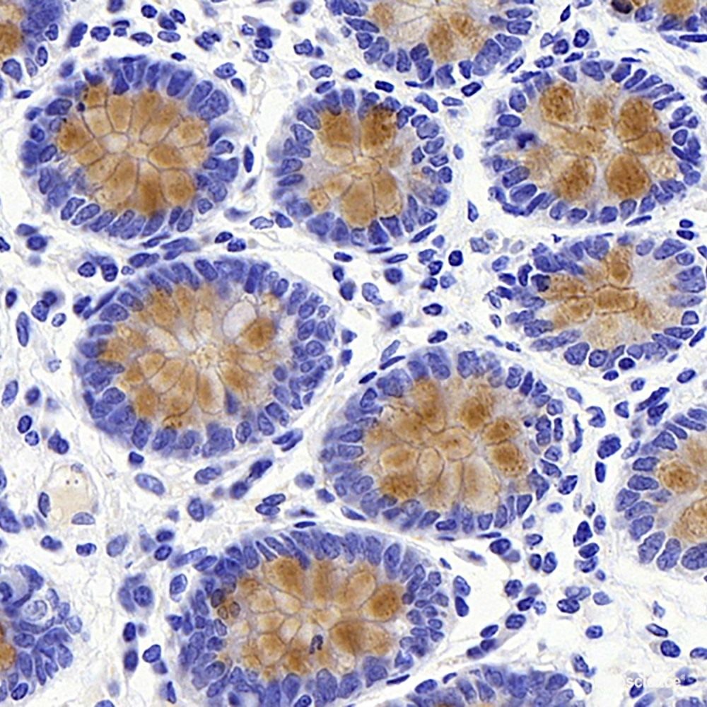 Immunohistochemistry analysis of paraffin-embedded mice tumor with hela  using SOX-2 Polyclonal Antibody at dilution of 1:300.