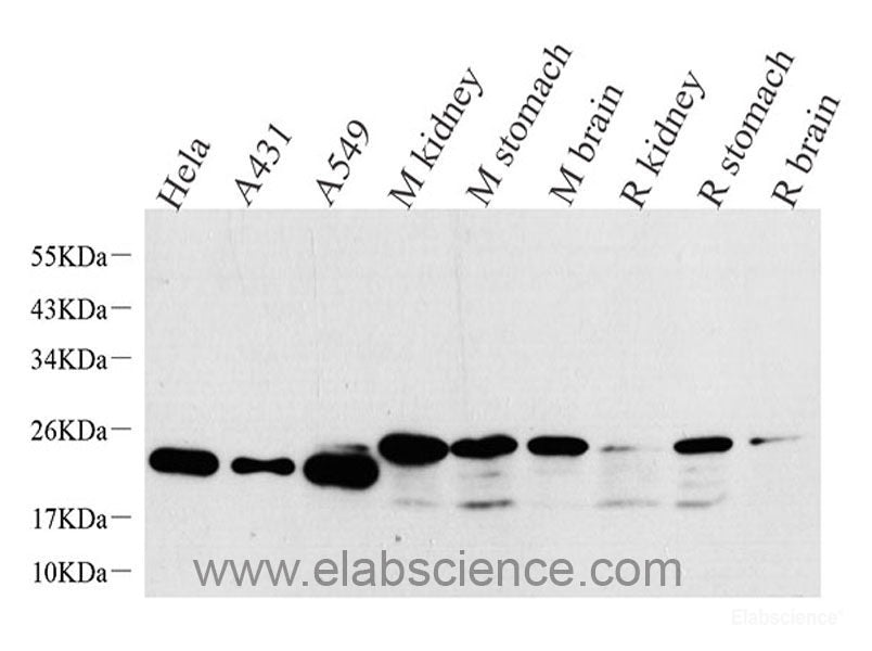 Immunohistochemistry analysis of paraffin-embedded human kidney  using AQP3 Polyclonal Antibody at dilution of 1:300.