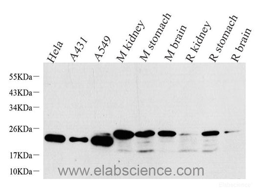 Immunohistochemistry analysis of paraffin-embedded human kidney  using AQP3 Polyclonal Antibody at dilution of 1:300.