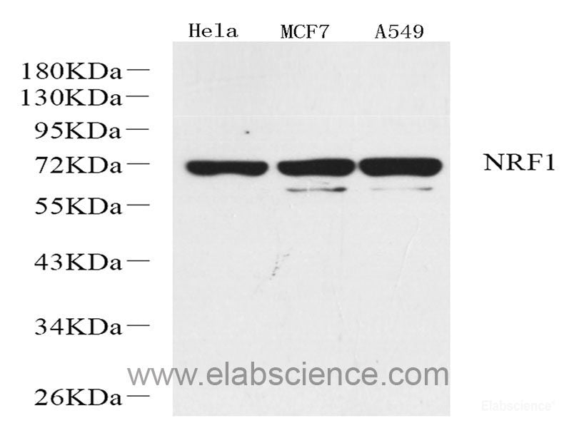 Immunohistochemistry analysis of paraffin-embedded human lung cancer   using JUN Polyclonal Antibody at dilution of 1:500.